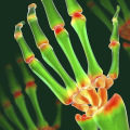 Does thca help arthritis?